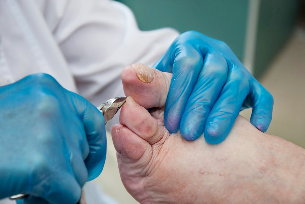 Podiatry. Diabetic foot. Foot Podiatrist