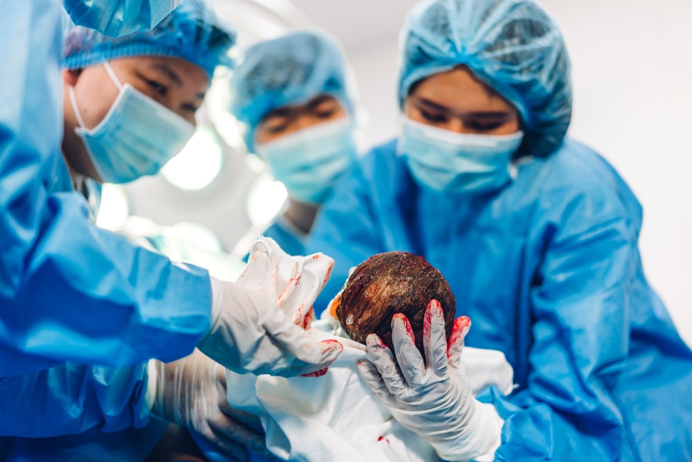 anesthesiologist doctor medical team is performing baby cesarean and hold the baby giving birth